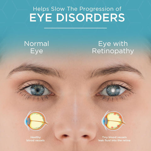 Viszen-M Eye Health Supplement